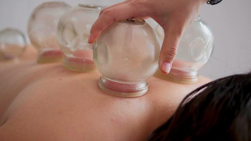 The benefits of Hijama